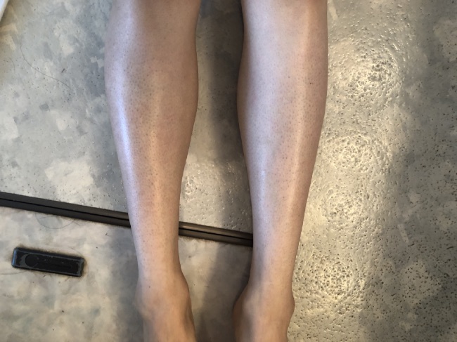 MONOVO除毛クリームを使い終わった後の両足