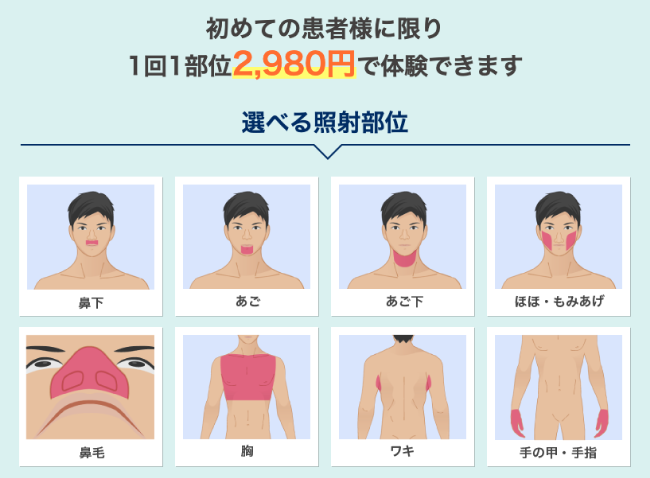 メンズリゼトライアル